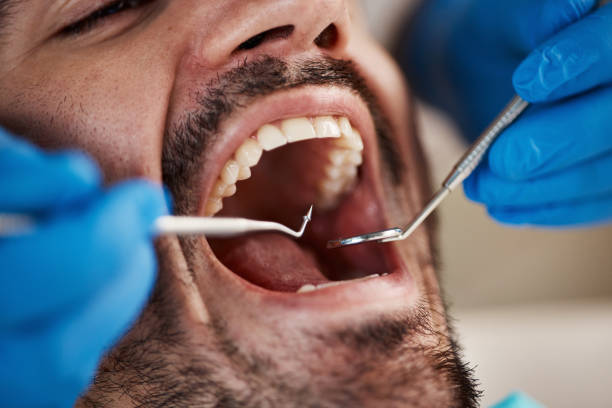 Best Emergency Treatment for Toothache in Norman, OK
